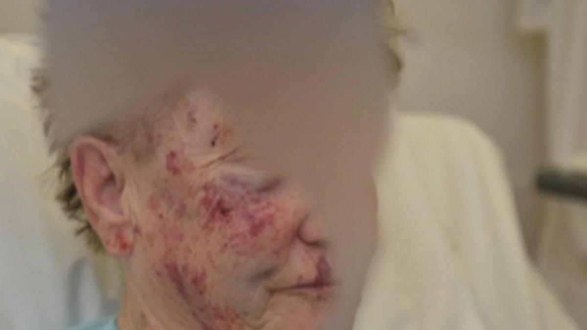 81jarige vrouw thuis mishandeld "Word nog elke nacht om drie uur wakker" NH Nieuws