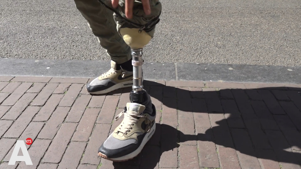 Lionel lost his prosthetic leg after a wild night of headbutts, but can now smile again