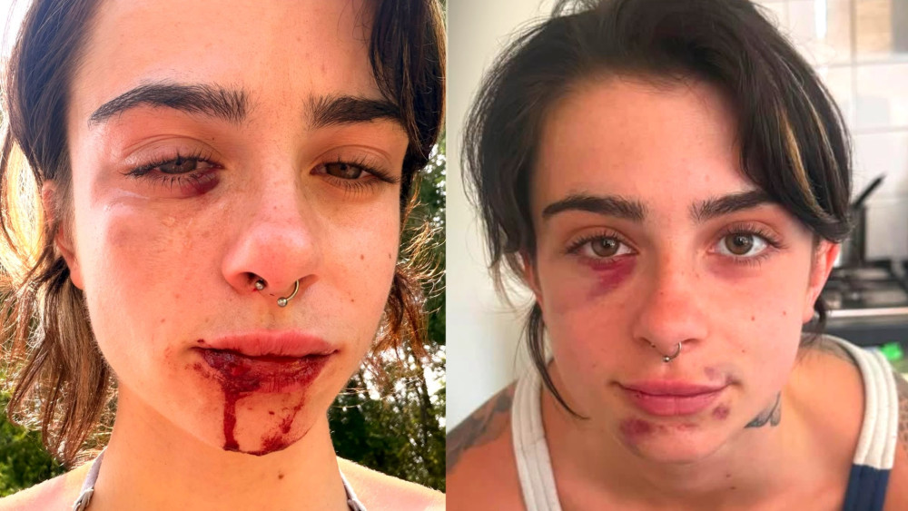Lizzy (21) from Haarlem severely assaulted out of nowhere at Veerplas